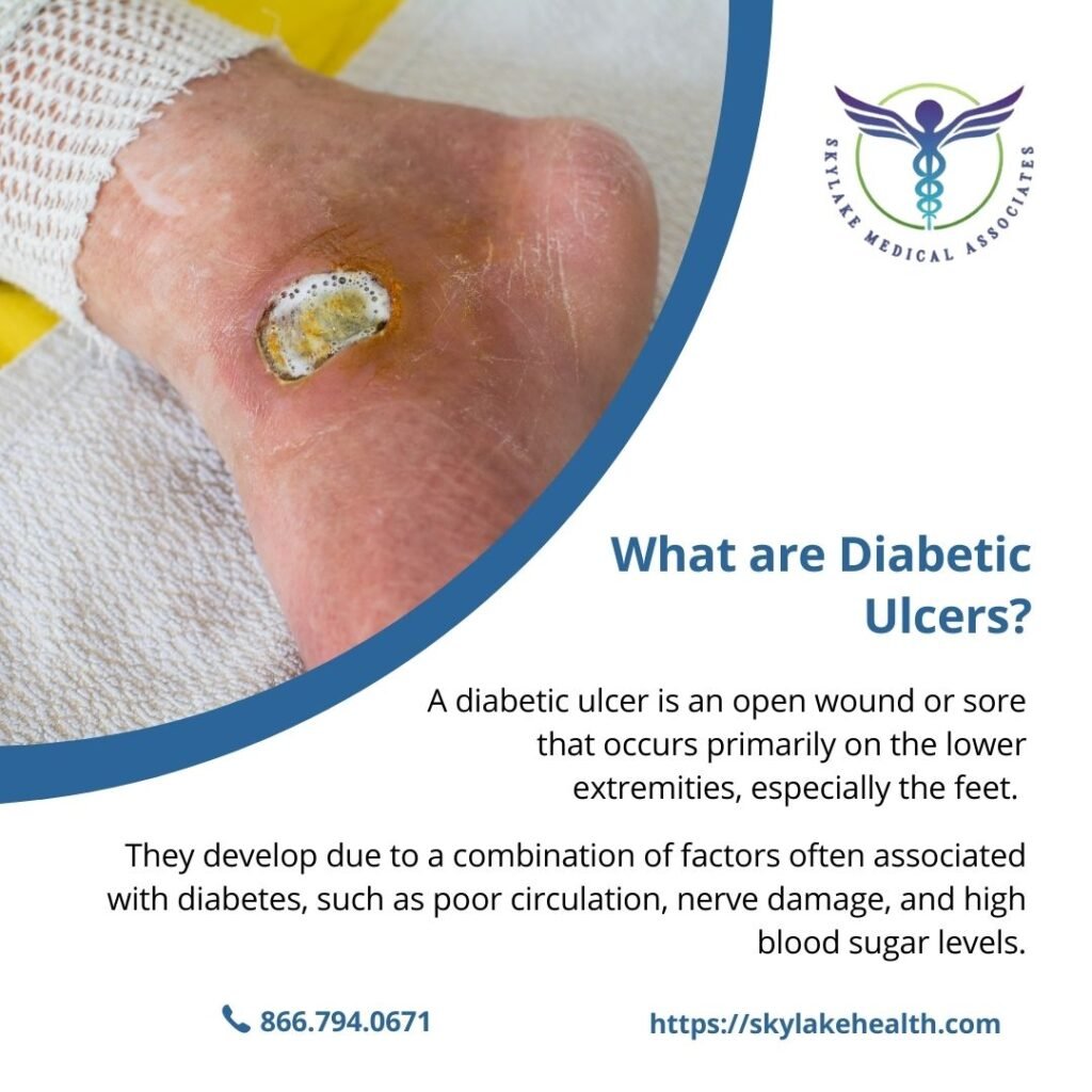 Understanding Diabetic Ulcers: Prevention and Treatment Options